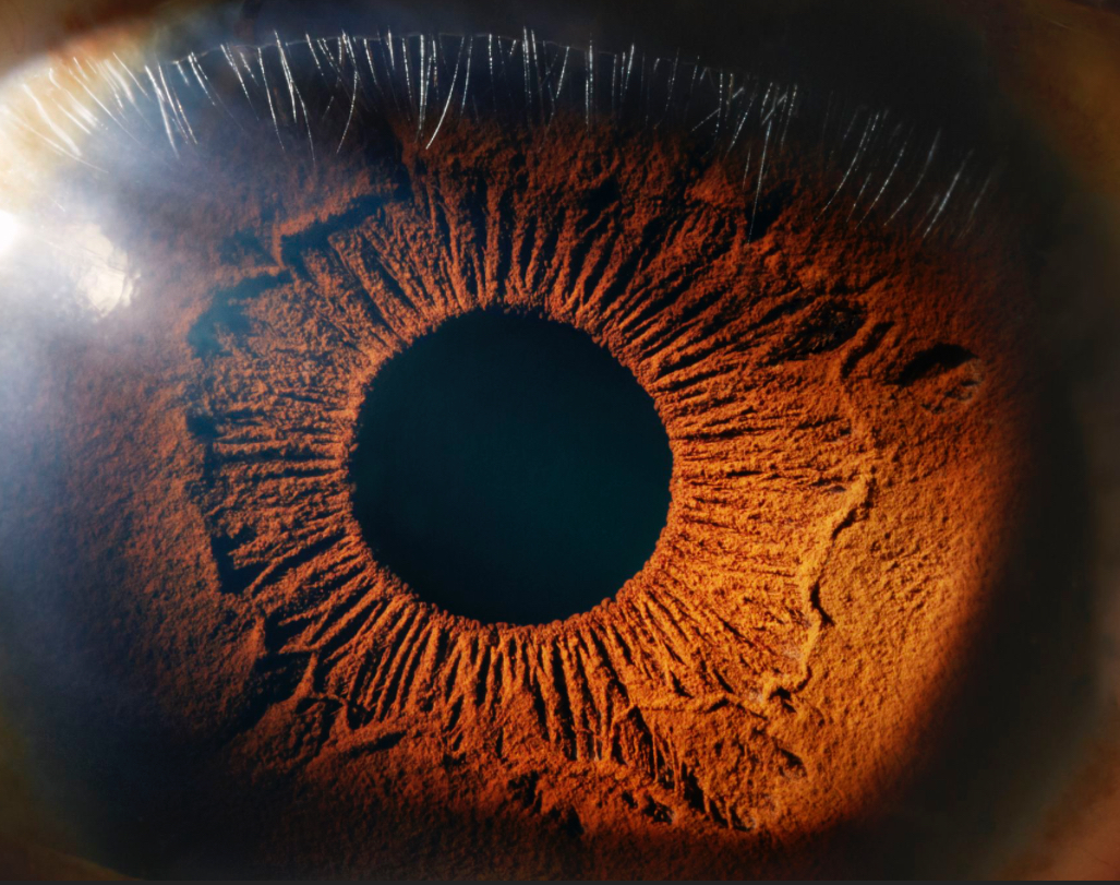 Iris